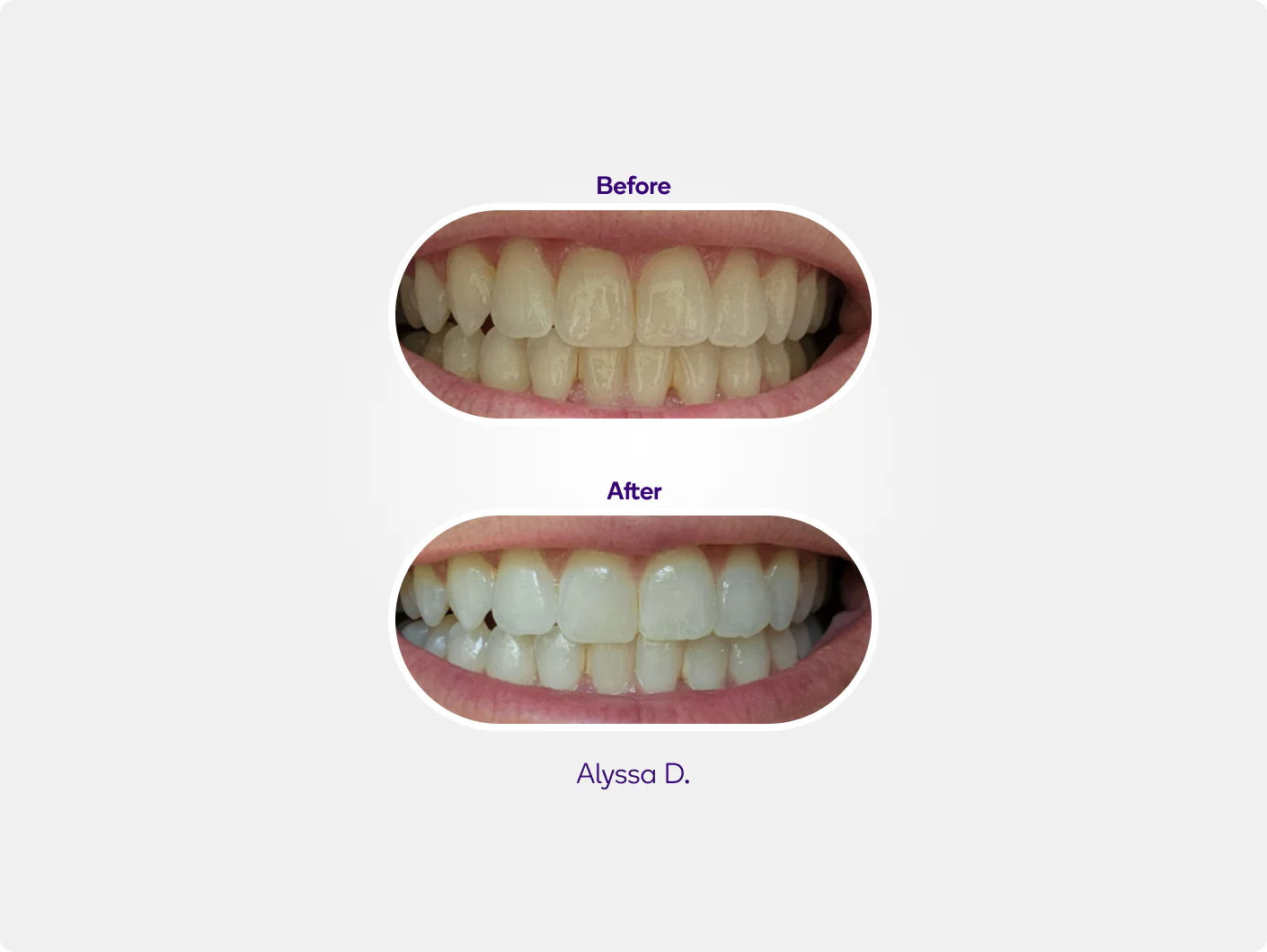 Precision Whitening Pen - Image 4