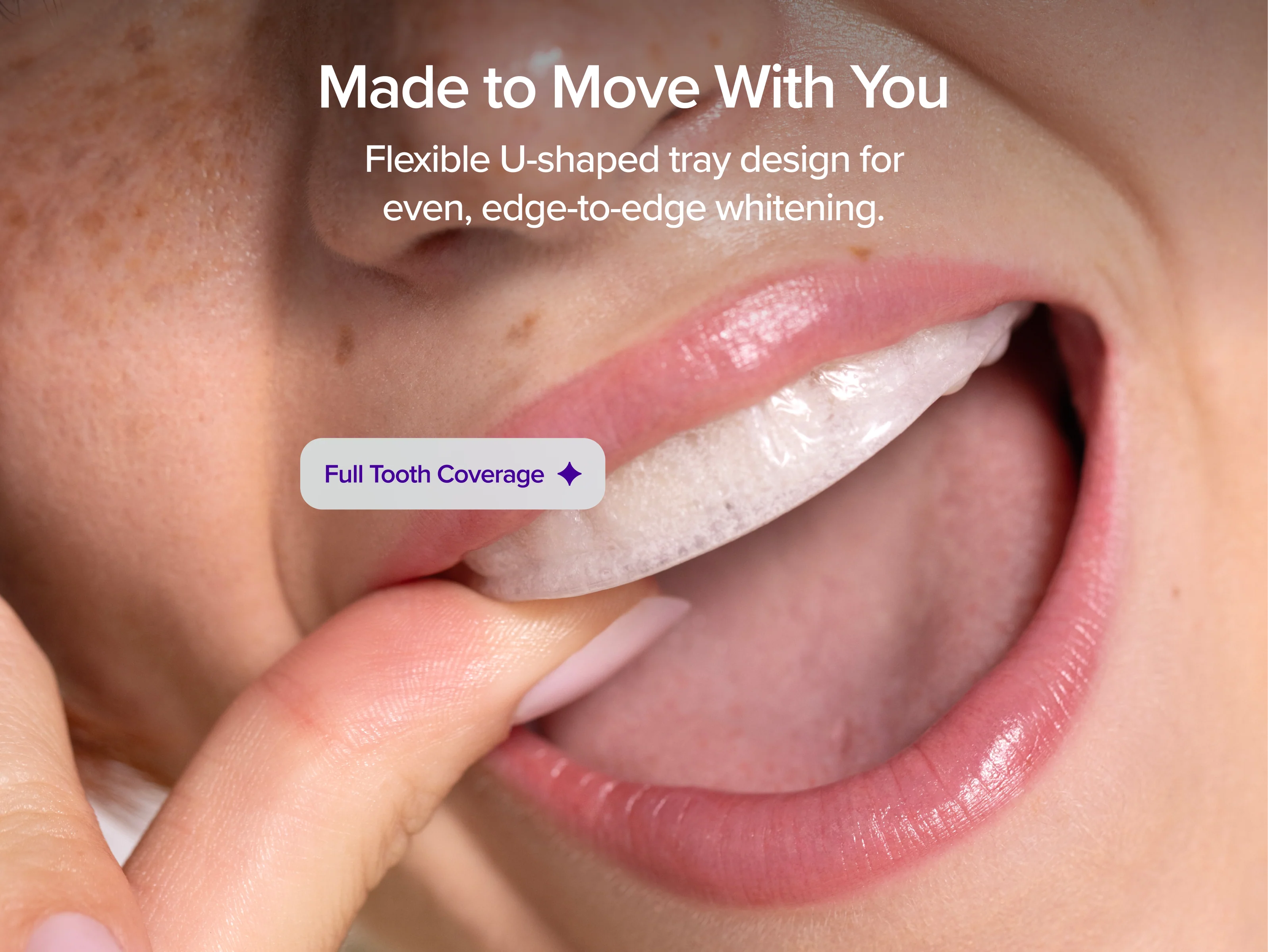 Prefilled Whitening Trays - Image 4